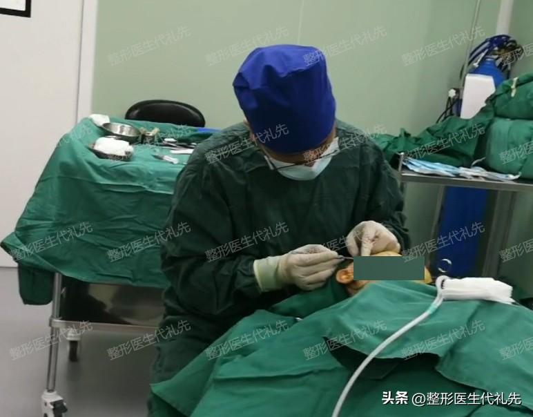 总结了最近准备做拉皮手术的求美者咨询的最多的8个问题-拉皮手术费用是多少