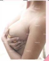 乳房提升手术怎么做？手术需要多少钱？-乳房提升手术后的注意事项