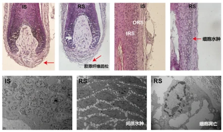 最前线｜头秃者的新福音，细胞冻存技术提升毛囊存活率-细胞冻存有哪些关键操作环节和技术