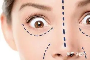 不看后悔~筋膜悬吊面部提升术原理，筋膜悬吊术有危害吗-筋膜悬吊术的原理图解