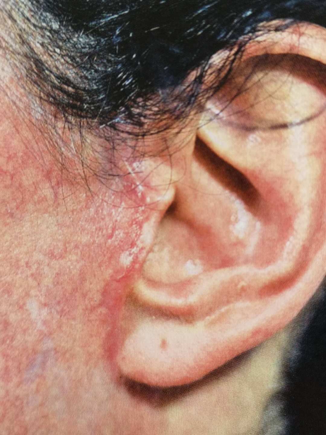 看了很多失败案例后不敢做面部提升，观望了一年才敢下定决心-如果做美容脸失败了怎么办?