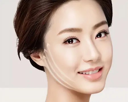 线雕可以提升紧致面部，改善轮廓和肤质，要注意这些人不适合线雕-线雕面部提升有什么后果吗?