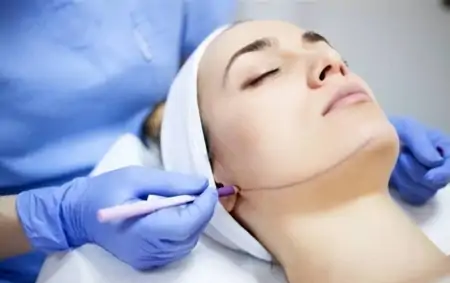 50岁鼓起勇气做拉皮，总结5点教训，句句都是大实话-五十岁女人做脸部拉皮有副作用吗