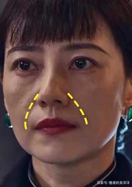 抗衰干货，如何改善面部下垂？-如何抵抗面部下垂