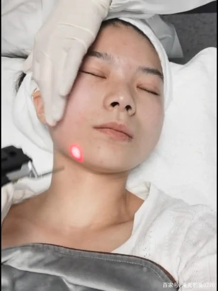 关于5D胶原光，你了解这些吗？-5d胶原光注意事项