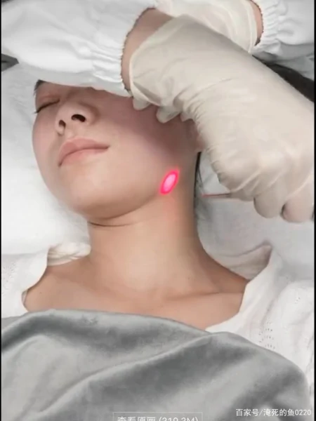 关于5D胶原光，你了解这些吗？-5d胶原光注意事项