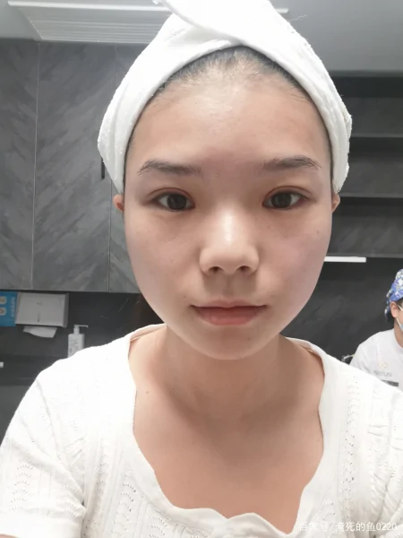 关于5D胶原光，你了解这些吗？-5d胶原光注意事项