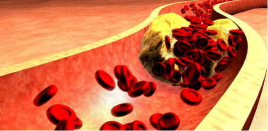 甘油三酯高吃什么才能降脂？胞倍力清血片药食同源可有效调理-甘油三酯什么药好