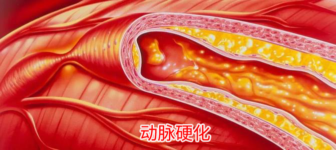 甘油三脂高对人体有什么危害？降低甘油三酯，这4招就够了-甘油三脂高怎么降下来