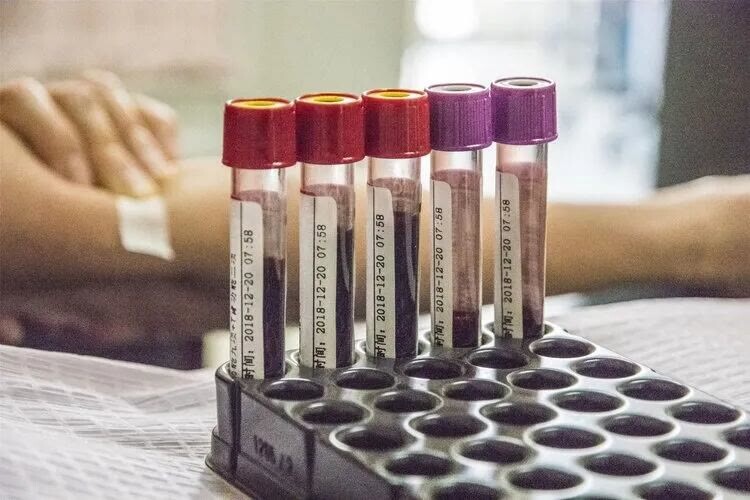 胆固醇和甘油三酯高是病吗？怎么治？医生分享3招轻松降脂-胆固醇和甘油三酯高是什么病