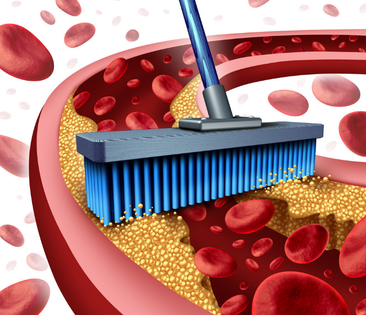 甘油三酯高，少吃三物，坚持三不，做好三勤，血脂降，减少并发症-甘油三酯高适合吃什么食物