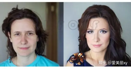 揭秘7d聚拉提大概全脸下来多少钱，7d聚拉提全脸多少钱做一次~-7d聚拉提全脸做一次能保持多久