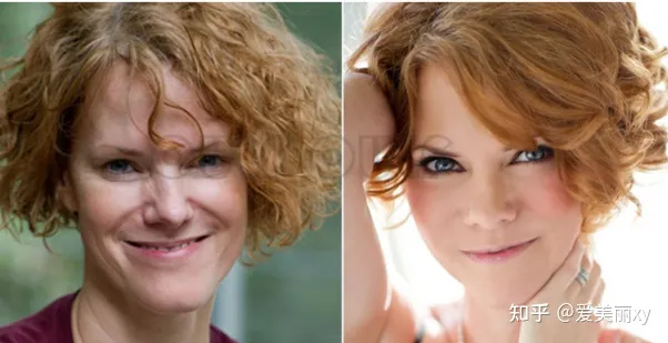 揭秘7d聚拉提大概全脸下来多少钱，7d聚拉提全脸多少钱做一次~-7d聚拉提全脸做一次能保持多久