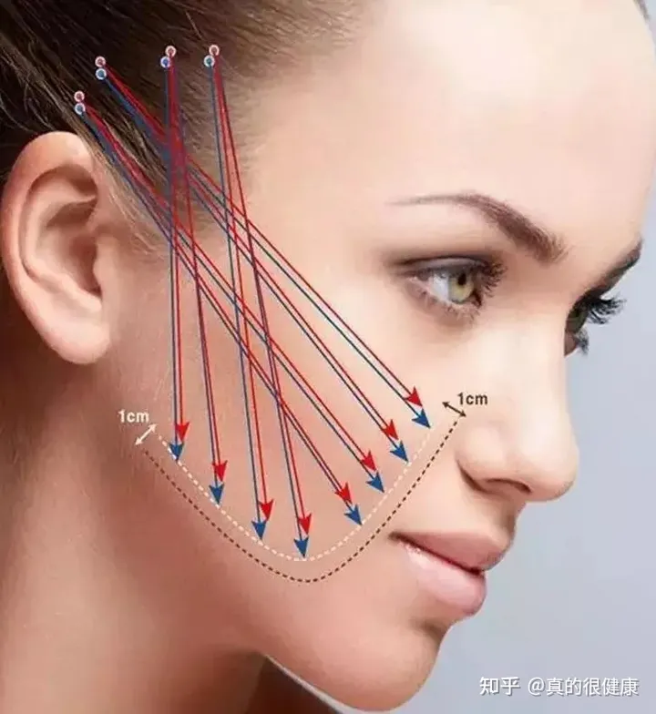 神普及：2021年7d聚拉提做全脸多少钱？7d聚拉提多久做一次？-7d聚拉提全脸多少发