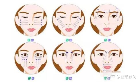 做全脸面部提升大概需要多少钱？怎么收费的？-做全脸提升美容多少钱?