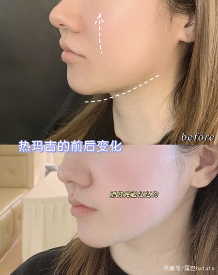 不同年龄应该怎么选择抗衰项目？-抗衰从多大年龄开始有效