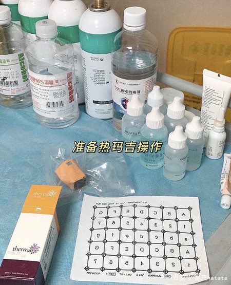 不同年龄应该怎么选择抗衰项目？-抗衰从多大年龄开始有效