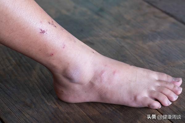 玉米须泡水喝真的能养生？中医：身体有这些问题的人，不妨试试！-玉米须泡水喝的用处