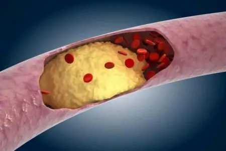 每天喝白酒，对血脂有什么影响？想要血脂稳定，可多喝5种茶水-白酒影响血脂吗