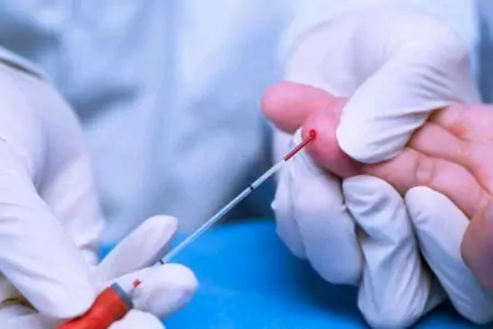 每天喝白酒，对血脂有什么影响？想要血脂稳定，可多喝5种茶水-白酒影响血脂吗