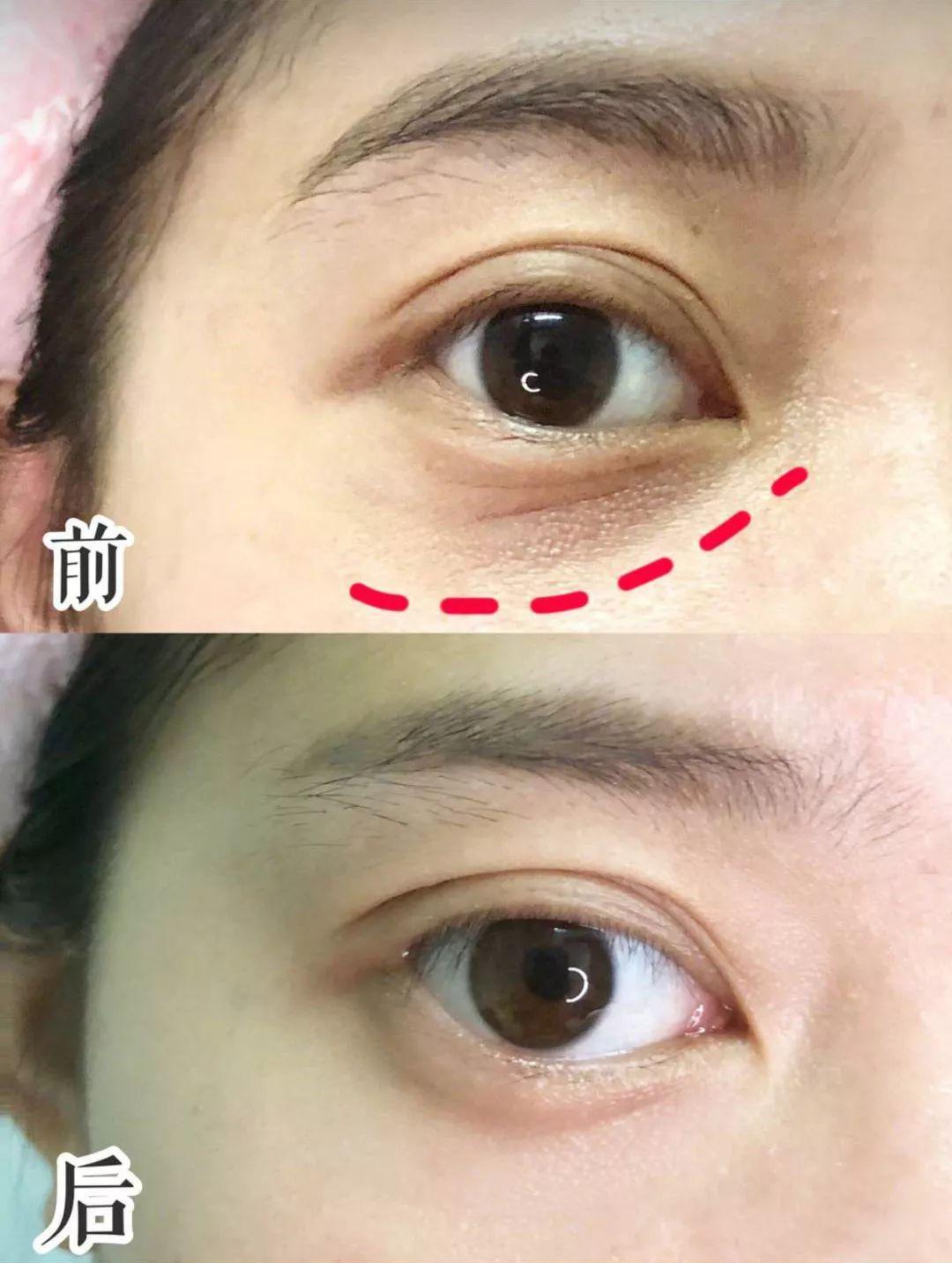 4款“抗老祖师爷”产品，娇兰、赫莲娜淡纹紧致，第4款空瓶最多（娇兰和赫莲娜面霜哪个好用）