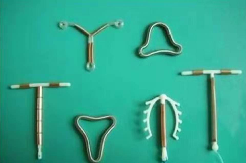 避孕上环有啥“副作用”？节育环逾期不取的危害，医生都为之心疼-避孕环时间到了不取可以吗