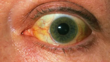 这些食物是肝部“大救星”，每天吃一点，养肝润肺，清除肝部垃圾（养肝的食物排行）