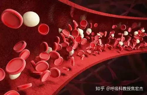 6大症状，预示你已经患上“贫血”了！做好这几点，远离贫血！-贫血的症状?