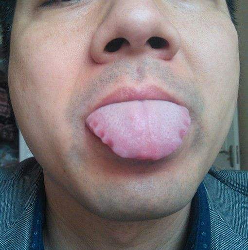 补药黄芪，三招自测，看你是否适合吃（黄芪补哪里）