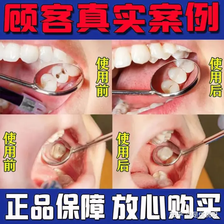 一个牙膏的骗局，请你小心！（牙膏知识知多少）