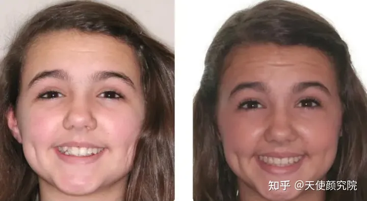 郑秀妍这段太蛊了吧！芒果台怎么能删了不播？？！（郑秀妍签约英皇）