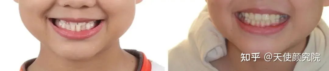 郑秀妍这段太蛊了吧！芒果台怎么能删了不播？？！（郑秀妍签约英皇）