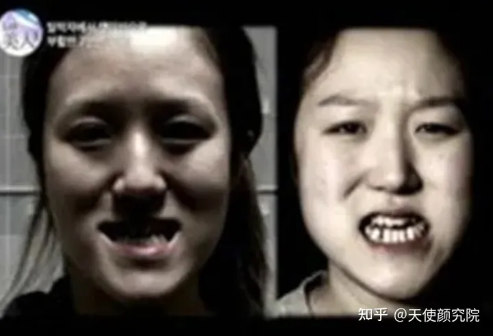 郑秀妍这段太蛊了吧！芒果台怎么能删了不播？？！（郑秀妍签约英皇）