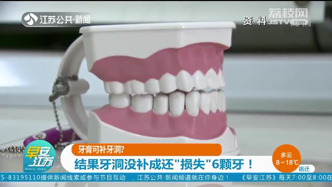 牙膏可补牙洞？结果牙洞没补成还“损失”6颗牙（牙膏可以补裂缝吗）