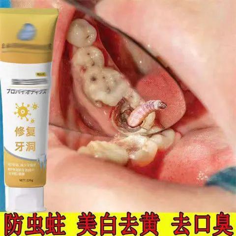 10 岁娃的牙烂 6 颗！这些「坑牙产品」你还在用吗？（10岁小孩牙齿烂了怎么办）