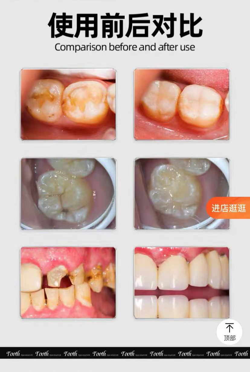 10 岁娃的牙烂 6 颗！这些「坑牙产品」你还在用吗？（10岁小孩牙齿烂了怎么办）