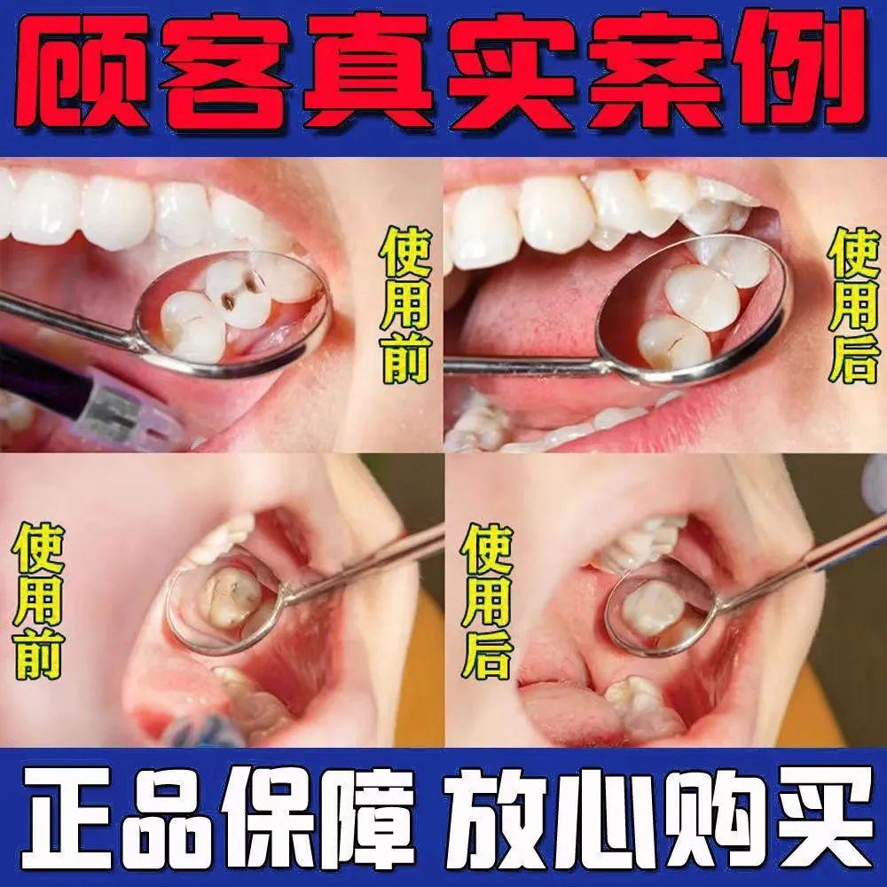 10 岁娃的牙烂 6 颗！这些「坑牙产品」你还在用吗？（10岁小孩牙齿烂了怎么办）