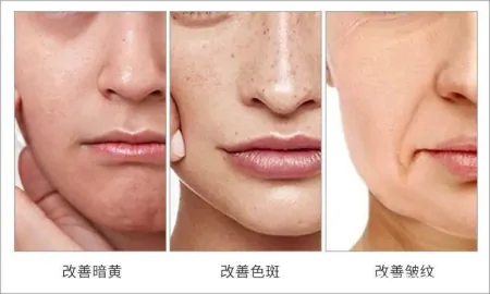 护肤品VS医美 哪个更值得？-护肤品和医美