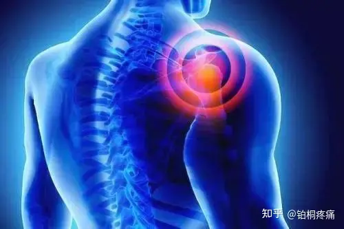 肩周炎的自我康复训练法，在家就可以练起来了（肩周炎的自我康复训练法,在家就可以练起来了吧）