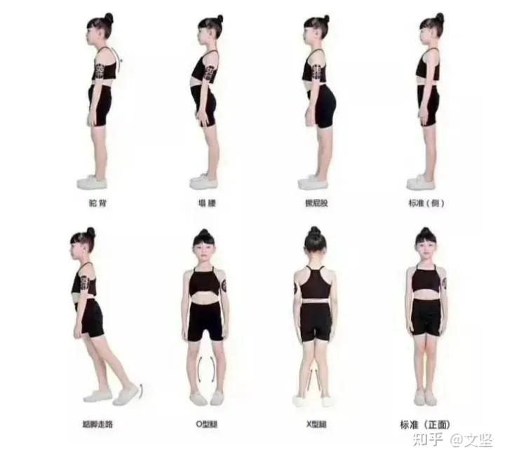 缓解肩周炎的动作：肩膀疼痛乏力？坚持做两个动作，肩膀越来越舒服，奥运冠军也在做！