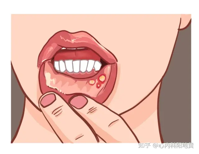 蒙脱石散登上热搜，医生提醒「不要乱用」，蒙脱石散有哪些药效？该如何正确用药？（婴儿蒙脱石散的用法）