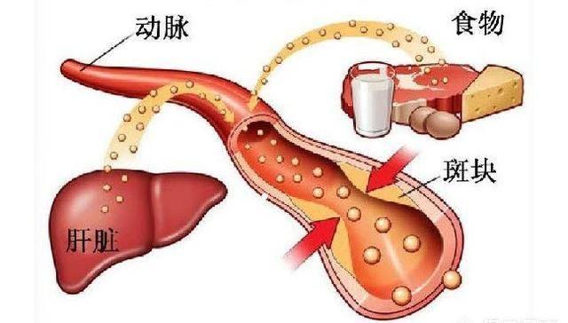 吃啥甘油三酯降得快？它的克星是什么？来看看医生给出的这些建议-吃什么甘油三酯高怎么降下来