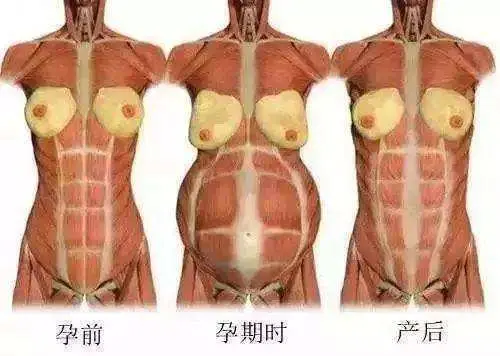 产后有必要做产后修复吗？花钱做产后修复是不是等于交“智商税”？-有没有必要花钱做产后修复