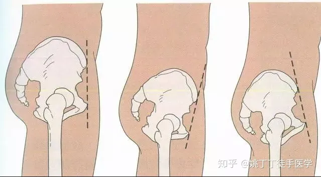 产后修复真的需要做吗?这一点产后修复中心可能没告诉你-产后修复有没有做的必要