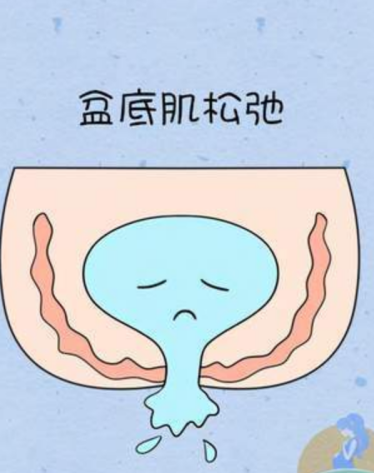 产后修复别只顾着身材，这个项目才真正影响你的健康-产后修复对身体有什么好处