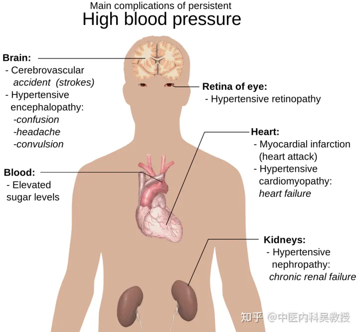 如何在不吃降压药的情况下，快速降血压-如果不吃降压药怎么能使血压降下来呀