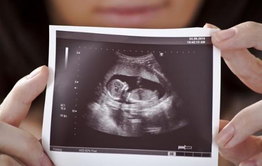 女人怀孕后的3个信号，比停经还要早一些，别不当回事-早孕停经前期的症状有哪些