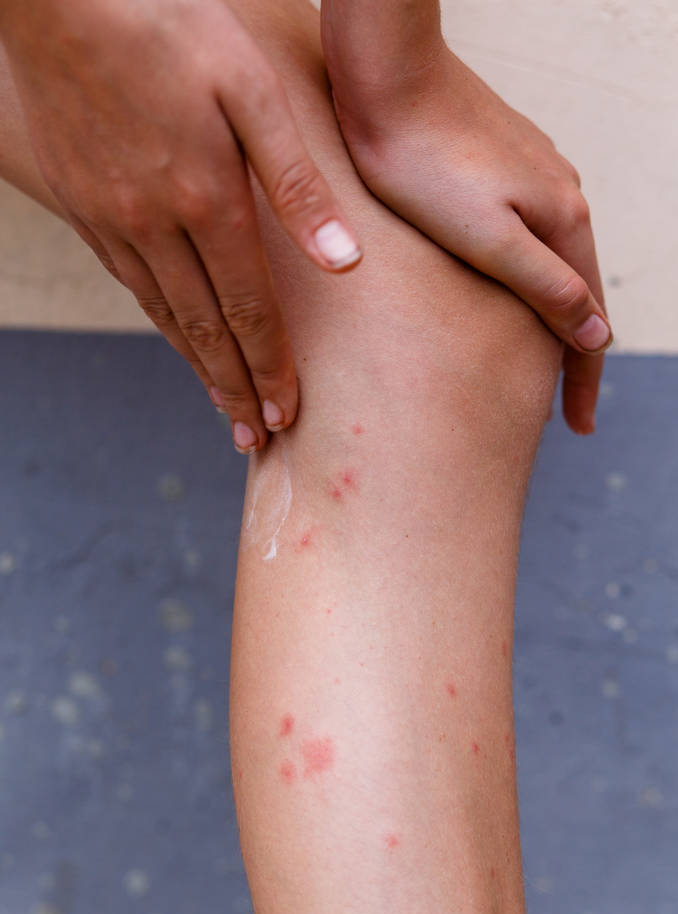 辽宁首次发现“蚊中贵族”，全身金黄体型大，被咬一口需冰敷-辽宁发现不明飞行物