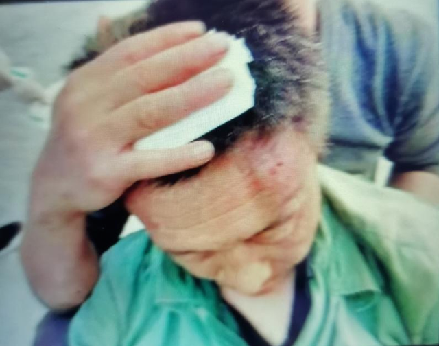 云投诉丨太平洋保险达州公司外包救援业务 救援人员无保险意外身亡谁负责？（达州太平洋保险电话号码）