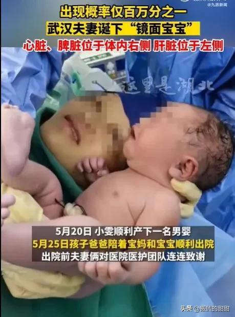 湖北武汉夫妻喜获“镜面宝宝”：神奇的生命之旅-武汉新婚夫妇过年风俗是什么